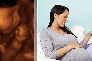4D ultrazvuk v těhotenství fotografie i záznam celého vyšetření na CD či na flash disku.