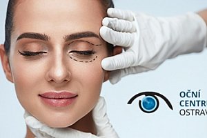 Plastická operace horních nebo dolních očních víček