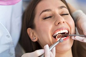 Dentální hygiena, Air Flow či bělení zubů pastou Opalescence