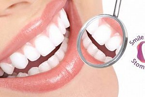 Kompletní dentální hygiena: odstranění zubního kamene, Air Flow