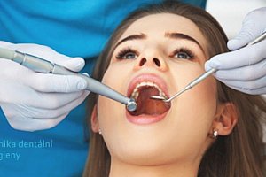 Dentální hygiena včetně Air Flow v délce 45-60 minut