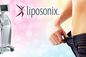 Neinvazivní liposukce Liposonix. Účinné a bezpečné odstranění tuků a celulitidy bez chirurgického zákroku.